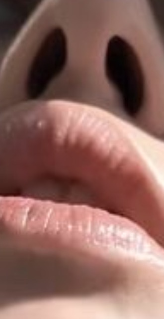 【画像】カリカリ女さんの鼻、ついにカイジ化まで行くｗｗｗ | 【画像】カリカリ女さんの鼻、ついにカイジ化まで行くｗｗｗ | 【画像】カリカリ女さんの鼻、ついにカイジ化まで行くｗｗｗ | 【画像】カリカリ女さんの鼻、ついにカイジ化まで行くｗｗｗ | やっちまった速報(画像07115824413226_4)