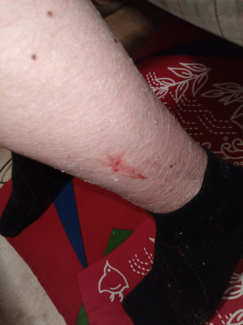 【閲覧注意】ワイの足、ガチでキモすぎると一部で話題にwwwwwwwwwwwwwww | 【閲覧注意】ワイの足、ガチでキモすぎると一部で話題にwwwwwwwwwwwwwww | 【閲覧注意】ワイの足、ガチでキモすぎると一部で話題にwwwwwwwwwwwwwww | 【閲覧注意】ワイの足、ガチでキモすぎると一部で話題にwwwwwwwwwwwwwww | 【閲覧注意】ワイの足、ガチでキモすぎると一部で話題にwwwwwwwwwwwwwww | 【閲覧注意】ワイの足、ガチでキモすぎると一部で話題にwwwwwwwwwwwwwww | 【閲覧注意】ワイの足、ガチでキモすぎると一部で話題にwwwwwwwwwwwwwww | 【閲覧注意】ワイの足、ガチでキモすぎると一部で話題にwwwwwwwwwwwwwww | 【閲覧注意】ワイの足、ガチでキモすぎると一部で話題にwwwwwwwwwwwwwww | 【閲覧注意】ワイの足、ガチでキモすぎると一部で話題にwwwwwwwwwwwwwww | やっちまった速報(画像28224428643994_10)