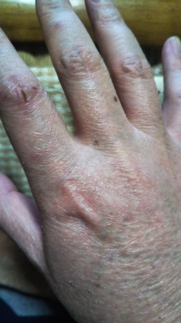 【閲覧注意】ワイの足、ガチでキモすぎると一部で話題にwwwwwwwwwwwwwww | 【閲覧注意】ワイの足、ガチでキモすぎると一部で話題にwwwwwwwwwwwwwww | 【閲覧注意】ワイの足、ガチでキモすぎると一部で話題にwwwwwwwwwwwwwww | 【閲覧注意】ワイの足、ガチでキモすぎると一部で話題にwwwwwwwwwwwwwww | 【閲覧注意】ワイの足、ガチでキモすぎると一部で話題にwwwwwwwwwwwwwww | 【閲覧注意】ワイの足、ガチでキモすぎると一部で話題にwwwwwwwwwwwwwww | 【閲覧注意】ワイの足、ガチでキモすぎると一部で話題にwwwwwwwwwwwwwww | 【閲覧注意】ワイの足、ガチでキモすぎると一部で話題にwwwwwwwwwwwwwww | 【閲覧注意】ワイの足、ガチでキモすぎると一部で話題にwwwwwwwwwwwwwww | 【閲覧注意】ワイの足、ガチでキモすぎると一部で話題にwwwwwwwwwwwwwww | 【閲覧注意】ワイの足、ガチでキモすぎると一部で話題にwwwwwwwwwwwwwww | やっちまった速報(画像28224429145934_11)