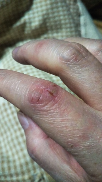 【閲覧注意】ワイの足、ガチでキモすぎると一部で話題にwwwwwwwwwwwwwww | 【閲覧注意】ワイの足、ガチでキモすぎると一部で話題にwwwwwwwwwwwwwww | 【閲覧注意】ワイの足、ガチでキモすぎると一部で話題にwwwwwwwwwwwwwww | 【閲覧注意】ワイの足、ガチでキモすぎると一部で話題にwwwwwwwwwwwwwww | 【閲覧注意】ワイの足、ガチでキモすぎると一部で話題にwwwwwwwwwwwwwww | 【閲覧注意】ワイの足、ガチでキモすぎると一部で話題にwwwwwwwwwwwwwww | 【閲覧注意】ワイの足、ガチでキモすぎると一部で話題にwwwwwwwwwwwwwww | 【閲覧注意】ワイの足、ガチでキモすぎると一部で話題にwwwwwwwwwwwwwww | 【閲覧注意】ワイの足、ガチでキモすぎると一部で話題にwwwwwwwwwwwwwww | 【閲覧注意】ワイの足、ガチでキモすぎると一部で話題にwwwwwwwwwwwwwww | 【閲覧注意】ワイの足、ガチでキモすぎると一部で話題にwwwwwwwwwwwwwww | 【閲覧注意】ワイの足、ガチでキモすぎると一部で話題にwwwwwwwwwwwwwww | やっちまった速報(画像28224429572019_12)