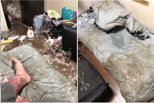 【閲覧注意】ワイの足、ガチでキモすぎると一部で話題にwwwwwwwwwwwwwww | 【閲覧注意】ワイの足、ガチでキモすぎると一部で話題にwwwwwwwwwwwwwww | 【閲覧注意】ワイの足、ガチでキモすぎると一部で話題にwwwwwwwwwwwwwww | 【閲覧注意】ワイの足、ガチでキモすぎると一部で話題にwwwwwwwwwwwwwww | 【閲覧注意】ワイの足、ガチでキモすぎると一部で話題にwwwwwwwwwwwwwww | 【閲覧注意】ワイの足、ガチでキモすぎると一部で話題にwwwwwwwwwwwwwww | 【閲覧注意】ワイの足、ガチでキモすぎると一部で話題にwwwwwwwwwwwwwww | 【閲覧注意】ワイの足、ガチでキモすぎると一部で話題にwwwwwwwwwwwwwww | 【閲覧注意】ワイの足、ガチでキモすぎると一部で話題にwwwwwwwwwwwwwww | 【閲覧注意】ワイの足、ガチでキモすぎると一部で話題にwwwwwwwwwwwwwww | 【閲覧注意】ワイの足、ガチでキモすぎると一部で話題にwwwwwwwwwwwwwww | 【閲覧注意】ワイの足、ガチでキモすぎると一部で話題にwwwwwwwwwwwwwww | 【閲覧注意】ワイの足、ガチでキモすぎると一部で話題にwwwwwwwwwwwwwww | やっちまった速報(画像28224430045599_13)