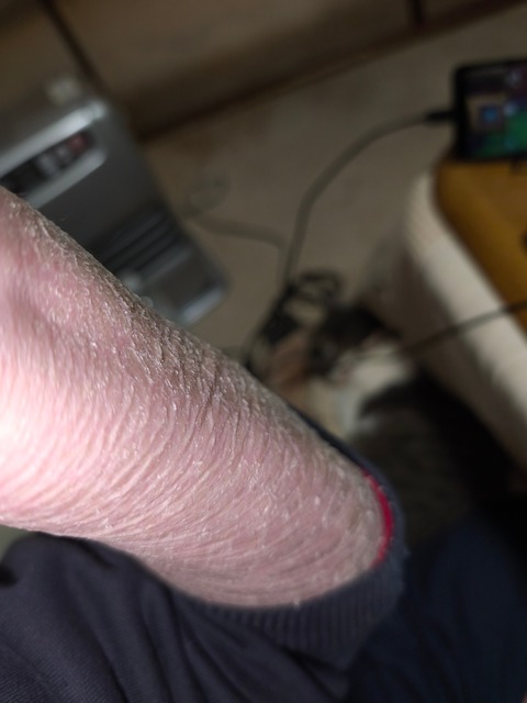 【閲覧注意】ワイの足、ガチでキモすぎると一部で話題にwwwwwwwwwwwwwww | 【閲覧注意】ワイの足、ガチでキモすぎると一部で話題にwwwwwwwwwwwwwww | 【閲覧注意】ワイの足、ガチでキモすぎると一部で話題にwwwwwwwwwwwwwww | 【閲覧注意】ワイの足、ガチでキモすぎると一部で話題にwwwwwwwwwwwwwww | 【閲覧注意】ワイの足、ガチでキモすぎると一部で話題にwwwwwwwwwwwwwww | やっちまった速報(画像28224426269525_5)