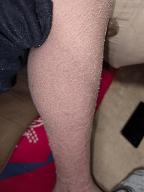 【閲覧注意】ワイの足、ガチでキモすぎると一部で話題にwwwwwwwwwwwwwww | 【閲覧注意】ワイの足、ガチでキモすぎると一部で話題にwwwwwwwwwwwwwww | 【閲覧注意】ワイの足、ガチでキモすぎると一部で話題にwwwwwwwwwwwwwww | 【閲覧注意】ワイの足、ガチでキモすぎると一部で話題にwwwwwwwwwwwwwww | 【閲覧注意】ワイの足、ガチでキモすぎると一部で話題にwwwwwwwwwwwwwww | 【閲覧注意】ワイの足、ガチでキモすぎると一部で話題にwwwwwwwwwwwwwww | 【閲覧注意】ワイの足、ガチでキモすぎると一部で話題にwwwwwwwwwwwwwww | やっちまった速報(画像28224427192229_7)