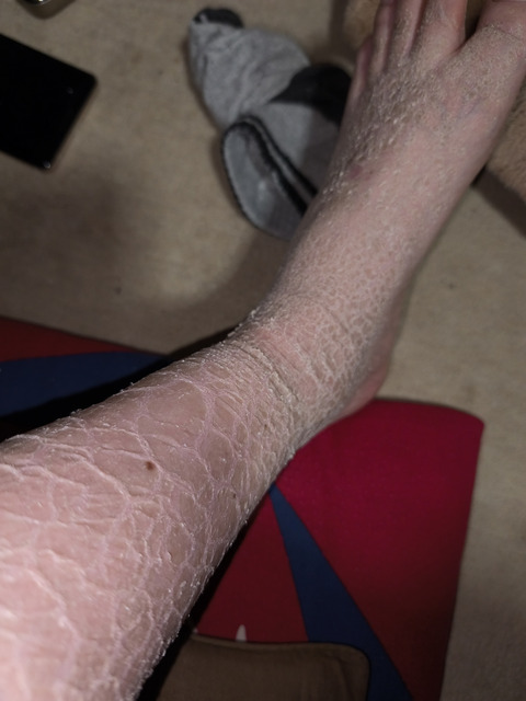 【閲覧注意】ワイの足、ガチでキモすぎると一部で話題にwwwwwwwwwwwwwww | 【閲覧注意】ワイの足、ガチでキモすぎると一部で話題にwwwwwwwwwwwwwww | 【閲覧注意】ワイの足、ガチでキモすぎると一部で話題にwwwwwwwwwwwwwww | 【閲覧注意】ワイの足、ガチでキモすぎると一部で話題にwwwwwwwwwwwwwww | 【閲覧注意】ワイの足、ガチでキモすぎると一部で話題にwwwwwwwwwwwwwww | 【閲覧注意】ワイの足、ガチでキモすぎると一部で話題にwwwwwwwwwwwwwww | 【閲覧注意】ワイの足、ガチでキモすぎると一部で話題にwwwwwwwwwwwwwww | 【閲覧注意】ワイの足、ガチでキモすぎると一部で話題にwwwwwwwwwwwwwww | やっちまった速報(画像28224427641554_8)