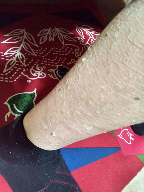 【閲覧注意】ワイの足、ガチでキモすぎると一部で話題にwwwwwwwwwwwwwww | 【閲覧注意】ワイの足、ガチでキモすぎると一部で話題にwwwwwwwwwwwwwww | 【閲覧注意】ワイの足、ガチでキモすぎると一部で話題にwwwwwwwwwwwwwww | 【閲覧注意】ワイの足、ガチでキモすぎると一部で話題にwwwwwwwwwwwwwww | 【閲覧注意】ワイの足、ガチでキモすぎると一部で話題にwwwwwwwwwwwwwww | 【閲覧注意】ワイの足、ガチでキモすぎると一部で話題にwwwwwwwwwwwwwww | 【閲覧注意】ワイの足、ガチでキモすぎると一部で話題にwwwwwwwwwwwwwww | 【閲覧注意】ワイの足、ガチでキモすぎると一部で話題にwwwwwwwwwwwwwww | 【閲覧注意】ワイの足、ガチでキモすぎると一部で話題にwwwwwwwwwwwwwww | やっちまった速報(画像28224428116993_9)