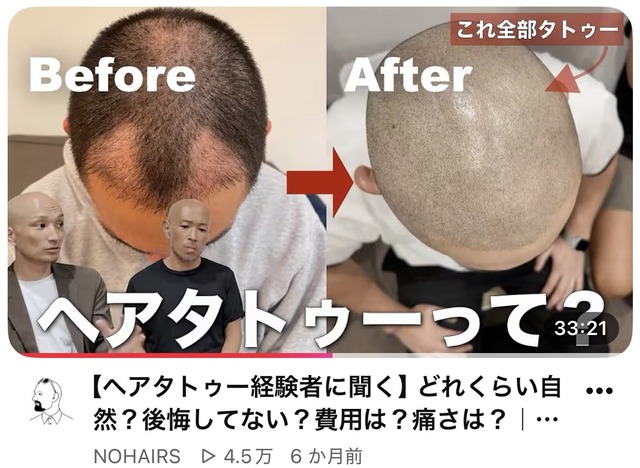 【悲報】日本人、「タトゥー」を入れる人間が急増してる模様ｗｗｗｗｗｗｗｗｗ | 【悲報】日本人、「タトゥー」を入れる人間が急増してる模様ｗｗｗｗｗｗｗｗｗ | 【悲報】日本人、「タトゥー」を入れる人間が急増してる模様ｗｗｗｗｗｗｗｗｗ | 【悲報】日本人、「タトゥー」を入れる人間が急増してる模様ｗｗｗｗｗｗｗｗｗ | 【悲報】日本人、「タトゥー」を入れる人間が急増してる模様ｗｗｗｗｗｗｗｗｗ | やっちまった速報(画像06100714491697_5)