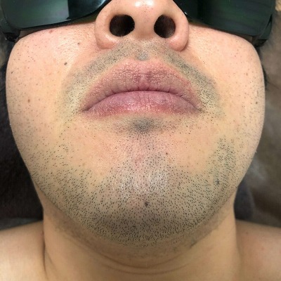 【悲報】青髭、ガチで消えないｗｗｗｗｗｗｗｗｗｗｗ | やっちまった速報(画像14052940258794_1)