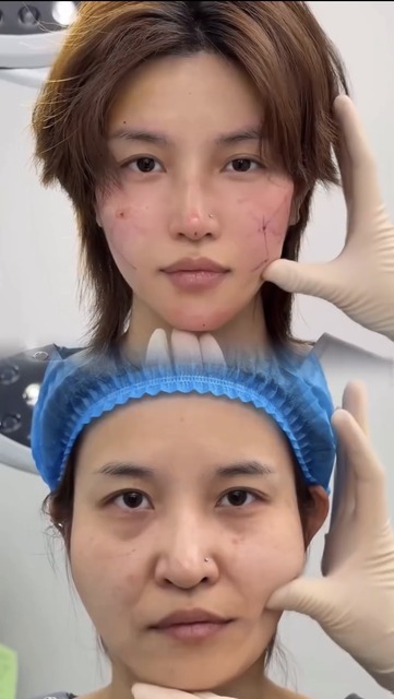 【画像】現役JK「整形は意味ないって言う弱者男性、これ見ても意味ないって言える？？」 | 【画像】現役JK「整形は意味ないって言う弱者男性、これ見ても意味ないって言える？？」 | 【画像】現役JK「整形は意味ないって言う弱者男性、これ見ても意味ないって言える？？」 | 【画像】現役JK「整形は意味ないって言う弱者男性、これ見ても意味ないって言える？？」 | 【画像】現役JK「整形は意味ないって言う弱者男性、これ見ても意味ないって言える？？」 | 【画像】現役JK「整形は意味ないって言う弱者男性、これ見ても意味ないって言える？？」 | 【画像】現役JK「整形は意味ないって言う弱者男性、これ見ても意味ないって言える？？」 | 【画像】現役JK「整形は意味ないって言う弱者男性、これ見ても意味ないって言える？？」 | 【画像】現役JK「整形は意味ないって言う弱者男性、これ見ても意味ないって言える？？」 | 【画像】現役JK「整形は意味ないって言う弱者男性、これ見ても意味ないって言える？？」 | 【画像】現役JK「整形は意味ないって言う弱者男性、これ見ても意味ないって言える？？」 | 【画像】現役JK「整形は意味ないって言う弱者男性、これ見ても意味ないって言える？？」 | 【画像】現役JK「整形は意味ないって言う弱者男性、これ見ても意味ないって言える？？」 | 【画像】現役JK「整形は意味ないって言う弱者男性、これ見ても意味ないって言える？？」 | 【画像】現役JK「整形は意味ないって言う弱者男性、これ見ても意味ないって言える？？」 | やっちまった速報(12130117877596_15)