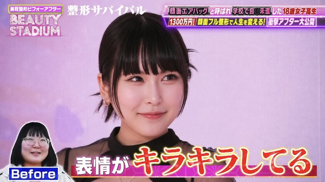 【画像】現役JK「整形は意味ないって言う弱者男性、これ見ても意味ないって言える？？」 | 【画像】現役JK「整形は意味ないって言う弱者男性、これ見ても意味ないって言える？？」 | 【画像】現役JK「整形は意味ないって言う弱者男性、これ見ても意味ないって言える？？」 | 【画像】現役JK「整形は意味ないって言う弱者男性、これ見ても意味ないって言える？？」 | 【画像】現役JK「整形は意味ないって言う弱者男性、これ見ても意味ないって言える？？」 | 【画像】現役JK「整形は意味ないって言う弱者男性、これ見ても意味ないって言える？？」 | 【画像】現役JK「整形は意味ないって言う弱者男性、これ見ても意味ないって言える？？」 | 【画像】現役JK「整形は意味ないって言う弱者男性、これ見ても意味ないって言える？？」 | 【画像】現役JK「整形は意味ないって言う弱者男性、これ見ても意味ないって言える？？」 | 【画像】現役JK「整形は意味ないって言う弱者男性、これ見ても意味ないって言える？？」 | 【画像】現役JK「整形は意味ないって言う弱者男性、これ見ても意味ないって言える？？」 | 【画像】現役JK「整形は意味ないって言う弱者男性、これ見ても意味ないって言える？？」 | 【画像】現役JK「整形は意味ないって言う弱者男性、これ見ても意味ないって言える？？」 | 【画像】現役JK「整形は意味ないって言う弱者男性、これ見ても意味ないって言える？？」 | 【画像】現役JK「整形は意味ないって言う弱者男性、これ見ても意味ないって言える？？」 | 【画像】現役JK「整形は意味ないって言う弱者男性、これ見ても意味ないって言える？？」 | やっちまった速報(12130118193350_16)