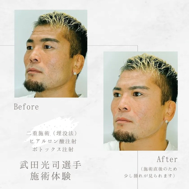 【画像】現役JK「整形は意味ないって言う弱者男性、これ見ても意味ないって言える？？」 | 【画像】現役JK「整形は意味ないって言う弱者男性、これ見ても意味ないって言える？？」 | 【画像】現役JK「整形は意味ないって言う弱者男性、これ見ても意味ないって言える？？」 | 【画像】現役JK「整形は意味ないって言う弱者男性、これ見ても意味ないって言える？？」 | 【画像】現役JK「整形は意味ないって言う弱者男性、これ見ても意味ないって言える？？」 | 【画像】現役JK「整形は意味ないって言う弱者男性、これ見ても意味ないって言える？？」 | 【画像】現役JK「整形は意味ないって言う弱者男性、これ見ても意味ないって言える？？」 | 【画像】現役JK「整形は意味ないって言う弱者男性、これ見ても意味ないって言える？？」 | 【画像】現役JK「整形は意味ないって言う弱者男性、これ見ても意味ないって言える？？」 | 【画像】現役JK「整形は意味ないって言う弱者男性、これ見ても意味ないって言える？？」 | 【画像】現役JK「整形は意味ないって言う弱者男性、これ見ても意味ないって言える？？」 | 【画像】現役JK「整形は意味ないって言う弱者男性、これ見ても意味ないって言える？？」 | 【画像】現役JK「整形は意味ないって言う弱者男性、これ見ても意味ないって言える？？」 | 【画像】現役JK「整形は意味ないって言う弱者男性、これ見ても意味ないって言える？？」 | 【画像】現役JK「整形は意味ないって言う弱者男性、これ見ても意味ないって言える？？」 | 【画像】現役JK「整形は意味ないって言う弱者男性、これ見ても意味ないって言える？？」 | 【画像】現役JK「整形は意味ないって言う弱者男性、これ見ても意味ないって言える？？」 | やっちまった速報(12130118570772_17)