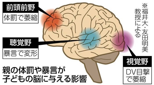 Youtube「ADHDの特徴はこれです！」ワイ「ファッ！？これワイそのものやんけ！！」 | Youtube「ADHDの特徴はこれです！」ワイ「ファッ！？これワイそのものやんけ！！」 | やっちまった速報(画像11094830703805_2)