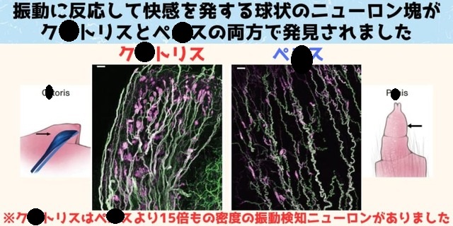 【緊急】ク●トリスが何なのか未だによくわかっていないやつ集合wwwwwwww | 【緊急】ク●トリスが何なのか未だによくわかっていないやつ集合wwwwwwww | 【緊急】ク●トリスが何なのか未だによくわかっていないやつ集合wwwwwwww | やっちまった速報(画像09001547083208_3) 【緊急】ク●トリスが何なのか未だによくわかっていないやつ集合wwwwwwww | 【緊急】ク●トリスが何なのか未だによくわかっていないやつ集合wwwwwwww | 【緊急】ク●トリスが何なのか未だによくわかっていないやつ集合wwwwwwww | やっちまった速報(画像09001547083208_3)