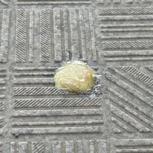 【画像】蓄膿症、顔の中がヤバイ状態になってしまう・・・・・ | 【画像】蓄膿症、顔の中がヤバイ状態になってしまう・・・・・ | 【画像】蓄膿症、顔の中がヤバイ状態になってしまう・・・・・ | 【画像】蓄膿症、顔の中がヤバイ状態になってしまう・・・・・ | 【画像】蓄膿症、顔の中がヤバイ状態になってしまう・・・・・ | 【画像】蓄膿症、顔の中がヤバイ状態になってしまう・・・・・ | 【画像】蓄膿症、顔の中がヤバイ状態になってしまう・・・・・ | 【画像】蓄膿症、顔の中がヤバイ状態になってしまう・・・・・ | 【画像】蓄膿症、顔の中がヤバイ状態になってしまう・・・・・ | 【画像】蓄膿症、顔の中がヤバイ状態になってしまう・・・・・ | 【画像】蓄膿症、顔の中がヤバイ状態になってしまう・・・・・ | 【画像】蓄膿症、顔の中がヤバイ状態になってしまう・・・・・ | やっちまった速報(画像02031748585318_12)