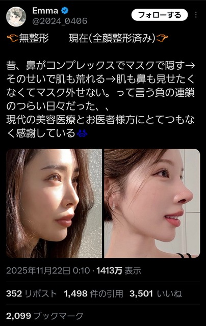 【大朗報】低身長男子、遺伝子的に顔整い(美形)が多いことが証明される　低身長の時代が来るw | 【大朗報】低身長男子、遺伝子的に顔整い(美形)が多いことが証明される　低身長の時代が来るw | 【大朗報】低身長男子、遺伝子的に顔整い(美形)が多いことが証明される　低身長の時代が来るw | 【大朗報】低身長男子、遺伝子的に顔整い(美形)が多いことが証明される　低身長の時代が来るw | 【大朗報】低身長男子、遺伝子的に顔整い(美形)が多いことが証明される　低身長の時代が来るw | 【大朗報】低身長男子、遺伝子的に顔整い(美形)が多いことが証明される　低身長の時代が来るw | 【大朗報】低身長男子、遺伝子的に顔整い(美形)が多いことが証明される　低身長の時代が来るw | 【大朗報】低身長男子、遺伝子的に顔整い(美形)が多いことが証明される　低身長の時代が来るw | 【大朗報】低身長男子、遺伝子的に顔整い(美形)が多いことが証明される　低身長の時代が来るw | やっちまった速報(画像24150816676992_9)