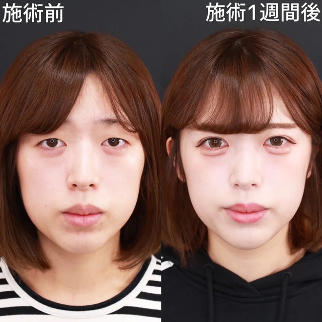 【悲報】「ポルトガル人」、Xで野蛮すぎるwwwwwwwwww | 【悲報】「ポルトガル人」、Xで野蛮すぎるwwwwwwwwww | 【悲報】「ポルトガル人」、Xで野蛮すぎるwwwwwwwwww | 【悲報】「ポルトガル人」、Xで野蛮すぎるwwwwwwwwww | 【悲報】「ポルトガル人」、Xで野蛮すぎるwwwwwwwwww | やっちまった速報(画像29030833038194_5)