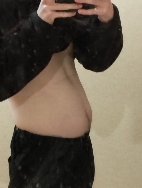 【画像】お前らガチのマジで嫌われてる『スキニーファット』じゃないよな？ | 【画像】お前らガチのマジで嫌われてる『スキニーファット』じゃないよな？ | やっちまった速報(画像25101849244531_2)