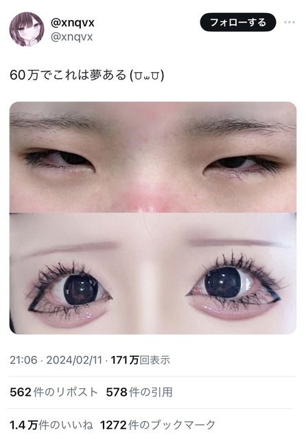 【画像】地雷系女子「これって斜視だよね？」→結果wwwwwwwwwww | 【画像】地雷系女子「これって斜視だよね？」→結果wwwwwwwwwww | 【画像】地雷系女子「これって斜視だよね？」→結果wwwwwwwwwww | 【画像】地雷系女子「これって斜視だよね？」→結果wwwwwwwwwww | 【画像】地雷系女子「これって斜視だよね？」→結果wwwwwwwwwww | 【画像】地雷系女子「これって斜視だよね？」→結果wwwwwwwwwww | やっちまった速報(画像06060510014861_6)