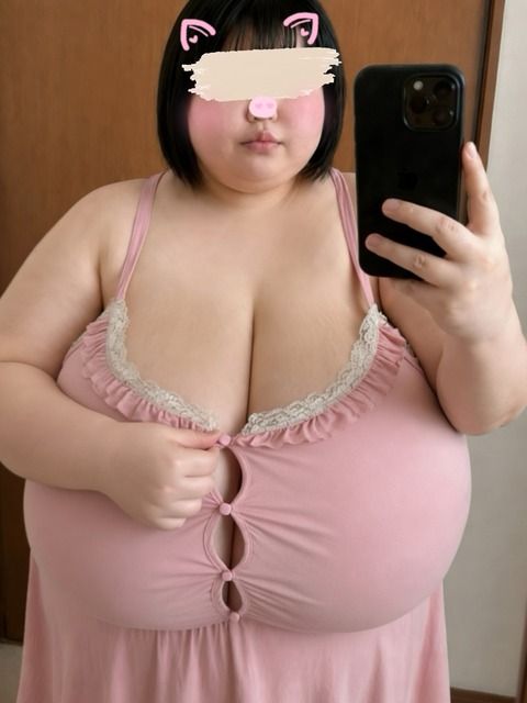 【画像】巨乳症のお●ぱい、あまりにも壮絶ｗｗｗｗ | 【画像】巨乳症のお●ぱい、あまりにも壮絶ｗｗｗｗ | 【画像】巨乳症のお●ぱい、あまりにも壮絶ｗｗｗｗ | やっちまった速報(19035452076323_3)