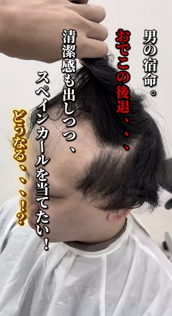 【画像】薄毛男性「センターパートにできますか？」美容師「はい、できますよ」 | 【画像】薄毛男性「センターパートにできますか？」美容師「はい、できますよ」 | 【画像】薄毛男性「センターパートにできますか？」美容師「はい、できますよ」 | 【画像】薄毛男性「センターパートにできますか？」美容師「はい、できますよ」 | 【画像】薄毛男性「センターパートにできますか？」美容師「はい、できますよ」 | 【画像】薄毛男性「センターパートにできますか？」美容師「はい、できますよ」 | 【画像】薄毛男性「センターパートにできますか？」美容師「はい、できますよ」 | 【画像】薄毛男性「センターパートにできますか？」美容師「はい、できますよ」 | 【画像】薄毛男性「センターパートにできますか？」美容師「はい、できますよ」 | 【画像】薄毛男性「センターパートにできますか？」美容師「はい、できますよ」 | 【画像】薄毛男性「センターパートにできますか？」美容師「はい、できますよ」 | 【画像】薄毛男性「センターパートにできますか？」美容師「はい、できますよ」 | 【画像】薄毛男性「センターパートにできますか？」美容師「はい、できますよ」 | 【画像】薄毛男性「センターパートにできますか？」美容師「はい、できますよ」 | 【画像】薄毛男性「センターパートにできますか？」美容師「はい、できますよ」 | 【画像】薄毛男性「センターパートにできますか？」美容師「はい、できますよ」 | 【画像】薄毛男性「センターパートにできますか？」美容師「はい、できますよ」 | 【画像】薄毛男性「センターパートにできますか？」美容師「はい、できますよ」 | やっちまった速報(20125500464978_18)