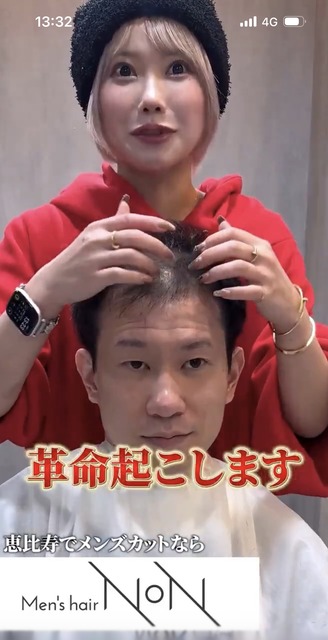 【画像】薄毛男性「センターパートにできますか？」美容師「はい、できますよ」 | 【画像】薄毛男性「センターパートにできますか？」美容師「はい、できますよ」 | 【画像】薄毛男性「センターパートにできますか？」美容師「はい、できますよ」 | 【画像】薄毛男性「センターパートにできますか？」美容師「はい、できますよ」 | 【画像】薄毛男性「センターパートにできますか？」美容師「はい、できますよ」 | 【画像】薄毛男性「センターパートにできますか？」美容師「はい、できますよ」 | やっちまった速報(20125454665388_6)