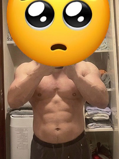 【画像】男の「筋肉整形」大ブームの兆しｗｗｗｗｗ | 【画像】男の「筋肉整形」大ブームの兆しｗｗｗｗｗ | 【画像】男の「筋肉整形」大ブームの兆しｗｗｗｗｗ | 【画像】男の「筋肉整形」大ブームの兆しｗｗｗｗｗ | 【画像】男の「筋肉整形」大ブームの兆しｗｗｗｗｗ | 【画像】男の「筋肉整形」大ブームの兆しｗｗｗｗｗ | 【画像】男の「筋肉整形」大ブームの兆しｗｗｗｗｗ | 【画像】男の「筋肉整形」大ブームの兆しｗｗｗｗｗ | 【画像】男の「筋肉整形」大ブームの兆しｗｗｗｗｗ | 【画像】男の「筋肉整形」大ブームの兆しｗｗｗｗｗ | やっちまった速報(23105508478821_10)