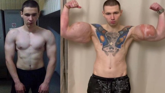 【画像】男の「筋肉整形」大ブームの兆しｗｗｗｗｗ | 【画像】男の「筋肉整形」大ブームの兆しｗｗｗｗｗ | 【画像】男の「筋肉整形」大ブームの兆しｗｗｗｗｗ | 【画像】男の「筋肉整形」大ブームの兆しｗｗｗｗｗ | 【画像】男の「筋肉整形」大ブームの兆しｗｗｗｗｗ | 【画像】男の「筋肉整形」大ブームの兆しｗｗｗｗｗ | 【画像】男の「筋肉整形」大ブームの兆しｗｗｗｗｗ | 【画像】男の「筋肉整形」大ブームの兆しｗｗｗｗｗ | 【画像】男の「筋肉整形」大ブームの兆しｗｗｗｗｗ | 【画像】男の「筋肉整形」大ブームの兆しｗｗｗｗｗ | 【画像】男の「筋肉整形」大ブームの兆しｗｗｗｗｗ | 【画像】男の「筋肉整形」大ブームの兆しｗｗｗｗｗ | 【画像】男の「筋肉整形」大ブームの兆しｗｗｗｗｗ | やっちまった速報(23105509484424_13)