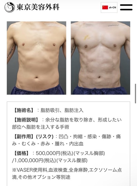 【画像】男の「筋肉整形」大ブームの兆しｗｗｗｗｗ | 【画像】男の「筋肉整形」大ブームの兆しｗｗｗｗｗ | 【画像】男の「筋肉整形」大ブームの兆しｗｗｗｗｗ | 【画像】男の「筋肉整形」大ブームの兆しｗｗｗｗｗ | 【画像】男の「筋肉整形」大ブームの兆しｗｗｗｗｗ | 【画像】男の「筋肉整形」大ブームの兆しｗｗｗｗｗ | 【画像】男の「筋肉整形」大ブームの兆しｗｗｗｗｗ | やっちまった速報(23105507502485_7)