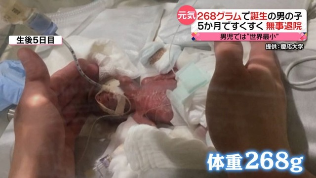 たぬかな「低体重出生児を産んだ母親に小さいってホンマ言ったらアカン」 | たぬかな「低体重出生児を産んだ母親に小さいってホンマ言ったらアカン」 | たぬかな「低体重出生児を産んだ母親に小さいってホンマ言ったらアカン」 | たぬかな「低体重出生児を産んだ母親に小さいってホンマ言ったらアカン」 | たぬかな「低体重出生児を産んだ母親に小さいってホンマ言ったらアカン」 | たぬかな「低体重出生児を産んだ母親に小さいってホンマ言ったらアカン」 | たぬかな「低体重出生児を産んだ母親に小さいってホンマ言ったらアカン」 | たぬかな「低体重出生児を産んだ母親に小さいってホンマ言ったらアカン」 | たぬかな「低体重出生児を産んだ母親に小さいってホンマ言ったらアカン」 | たぬかな「低体重出生児を産んだ母親に小さいってホンマ言ったらアカン」 | たぬかな「低体重出生児を産んだ母親に小さいってホンマ言ったらアカン」 | たぬかな「低体重出生児を産んだ母親に小さいってホンマ言ったらアカン」 | たぬかな「低体重出生児を産んだ母親に小さいってホンマ言ったらアカン」 | たぬかな「低体重出生児を産んだ母親に小さいってホンマ言ったらアカン」 | やっちまった速報(30201534235622_14)